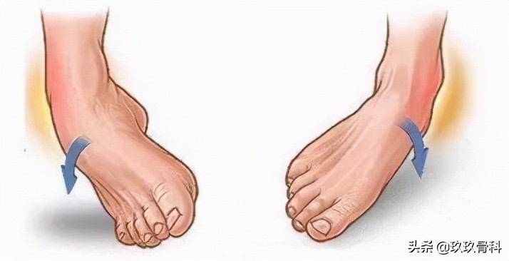 踝关节受伤小腿肌肉萎缩怎么锻炼,踝关节受伤后怎么锻炼