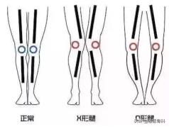跳高体育之星,跳高的理想身高