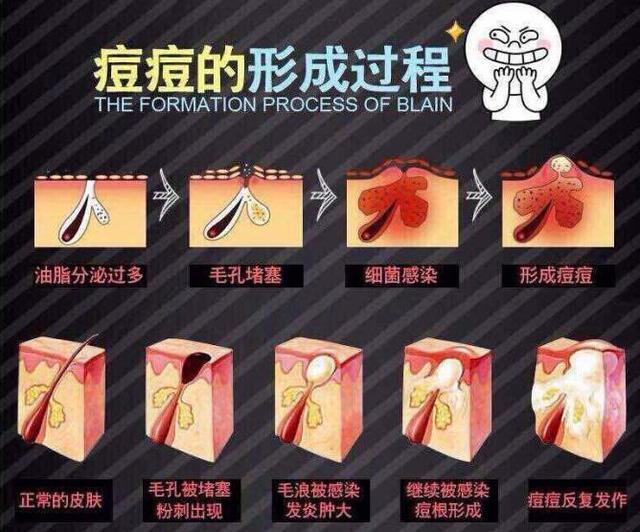 *生活性**能祛痘？是妹子打着幌子找男朋友还是汉子为了骗炮而科普？