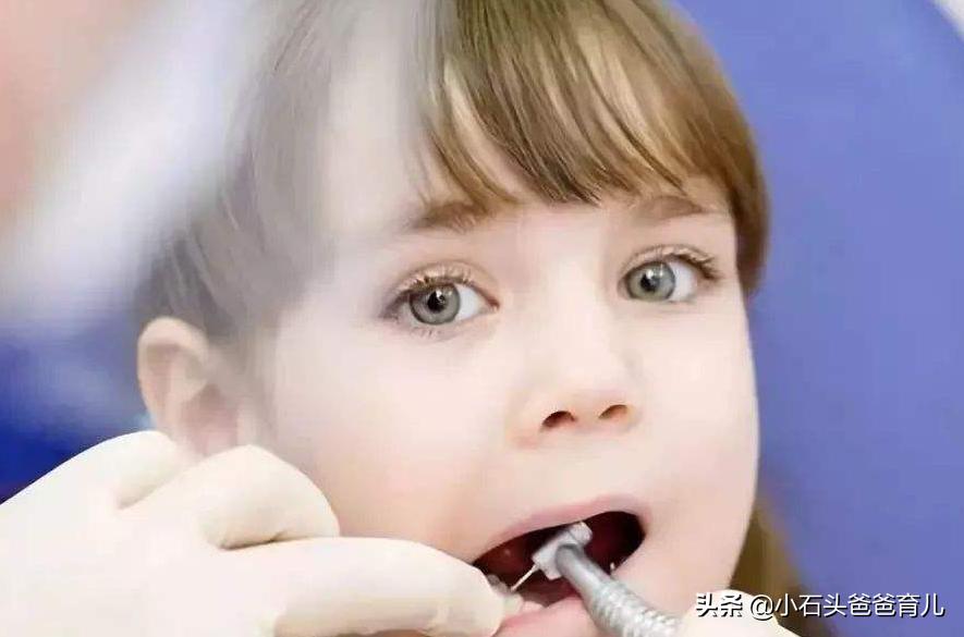 儿童4周岁天天刷牙还是不断蛀牙,小孩子天天刷牙还是长虫牙