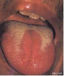 最实用的舌诊图六大舌象,舌诊深入学习书