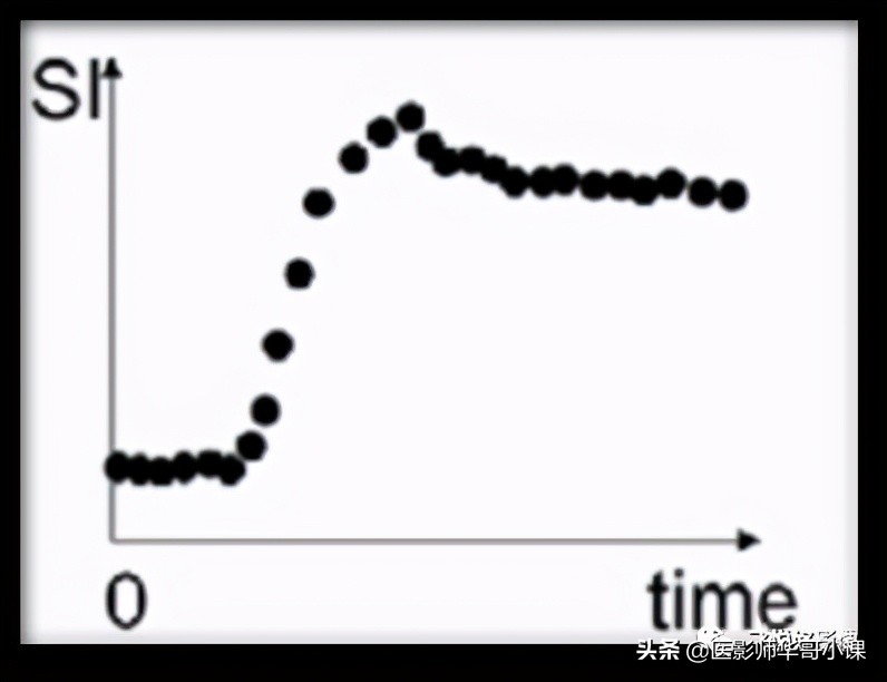 「飞利浦磁共振技术」DCE技术原理及应用（二）