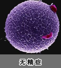 无精症中医调精子,男科无精症偏方