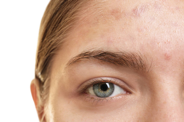 胸前的疤痕疙瘩怎么办,胸前的疤痕疙瘩怎么穿衣服