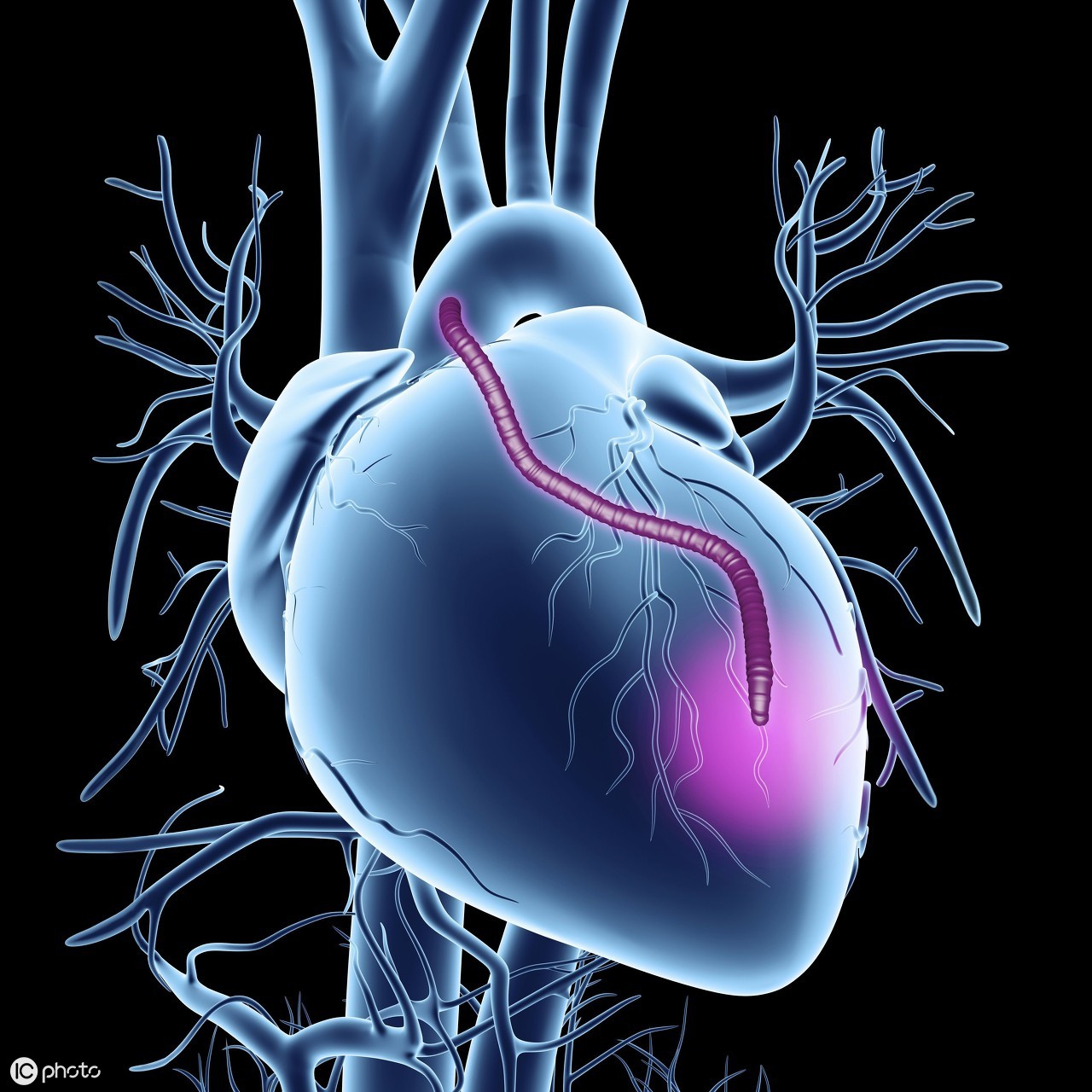 心衰特效药200元一粒的是啥,高血压药1片7分钱