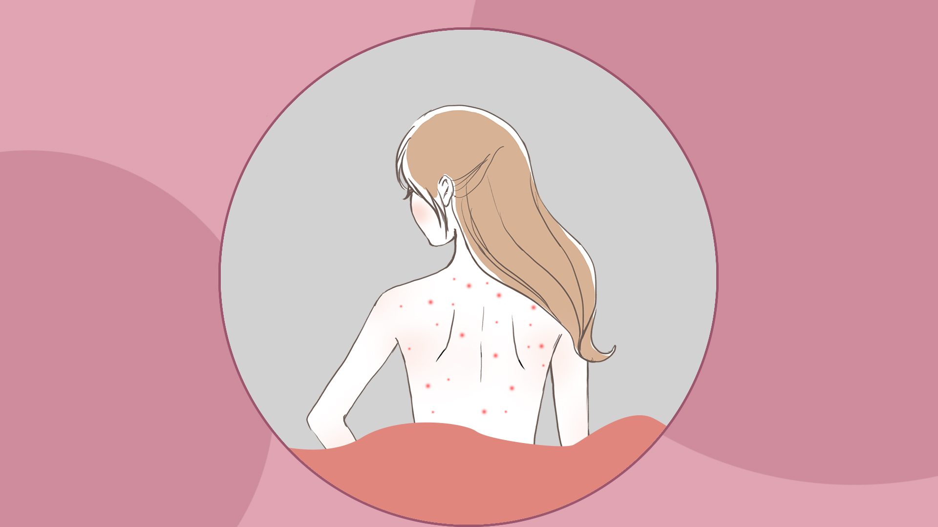 孩子青春期长痘痘，家长不要不在意，这些小技巧帮助您