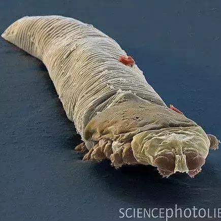 狗狗身上起红疹子是怎么回事,狗狗身上起红疹又脱毛