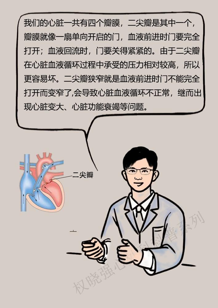 心脏二尖瓣狭窄怎么治疗,二尖瓣狭窄重度能活多久