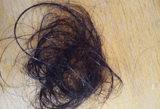 南昌第12医院植发靠谱吗,南昌植发机构的毛囊从哪来