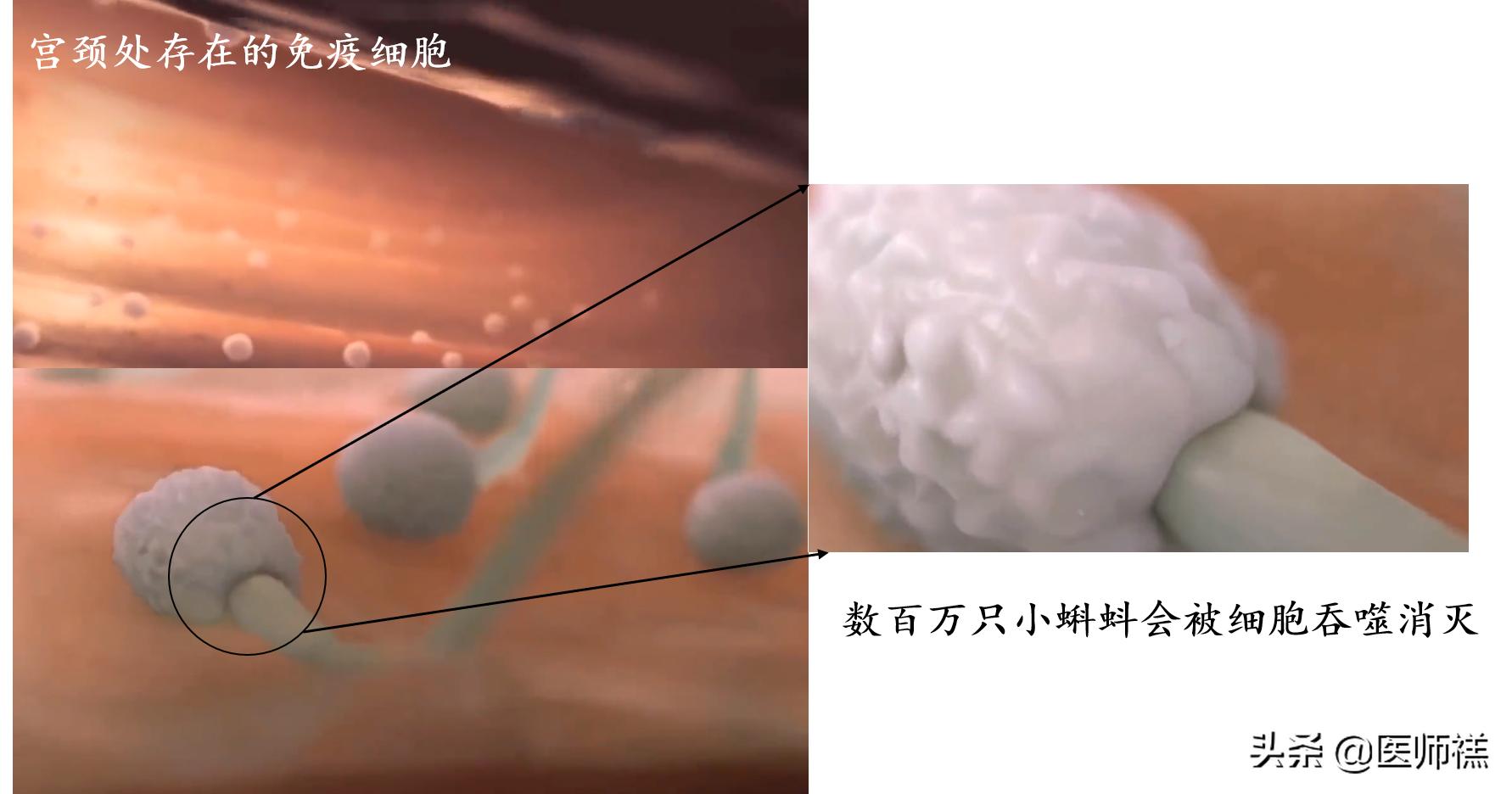 备孕时女人倒立真的更容易怀孕吗,备孕倒立多长时间最佳