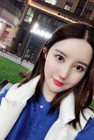 双眼皮修复内宽改窄真实案例,双眼皮修复宽改窄后期案例