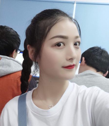 双眼皮修复内宽改窄真实案例,双眼皮修复宽改窄后期案例