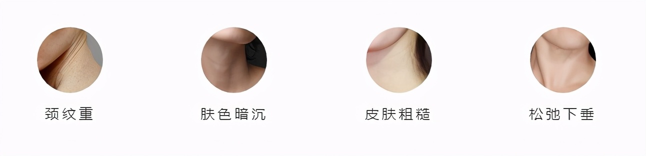 日置秘籍｜“颈”报已响，呵护要趁早