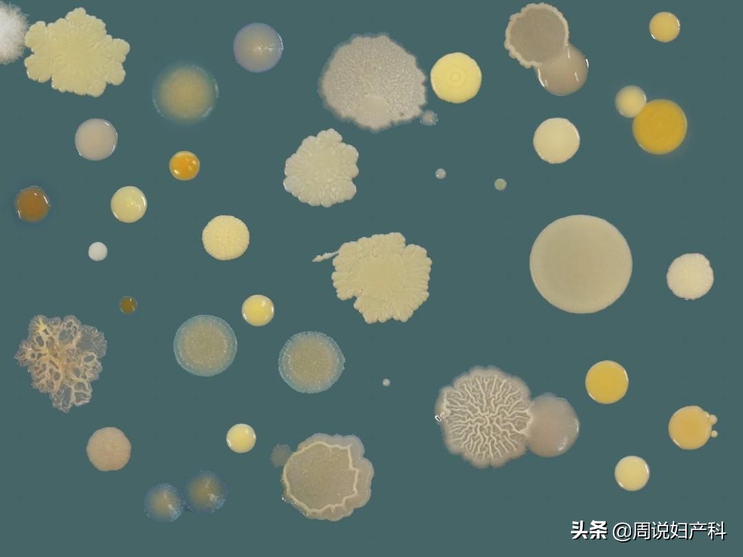 下面总是痒？也许是这个“好习惯”在作怪