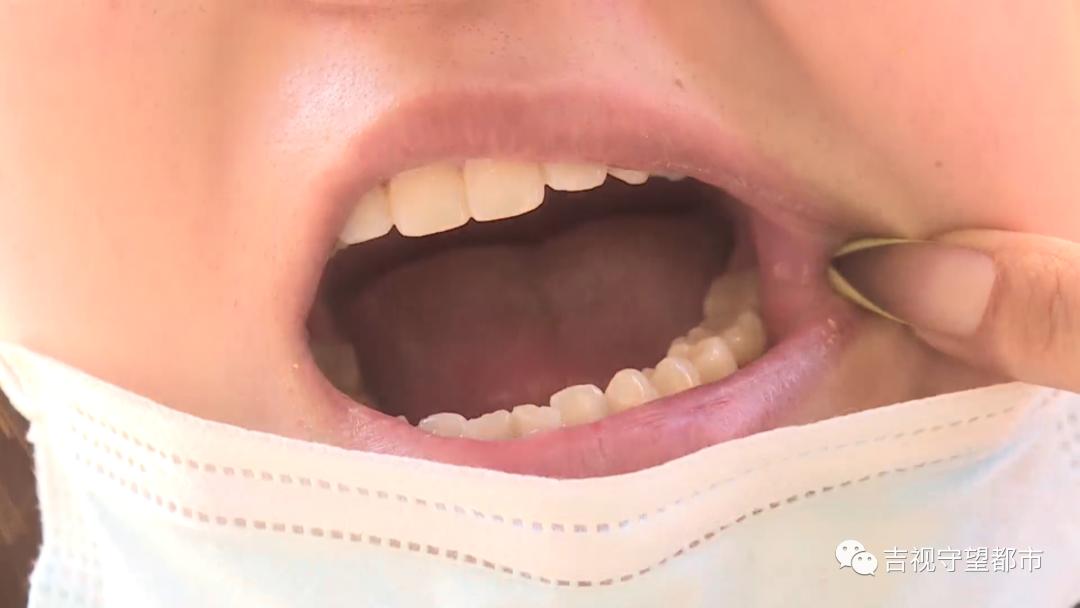 长春市最便宜的烤瓷牙多少钱,长春烤瓷牙做得好的口腔医院