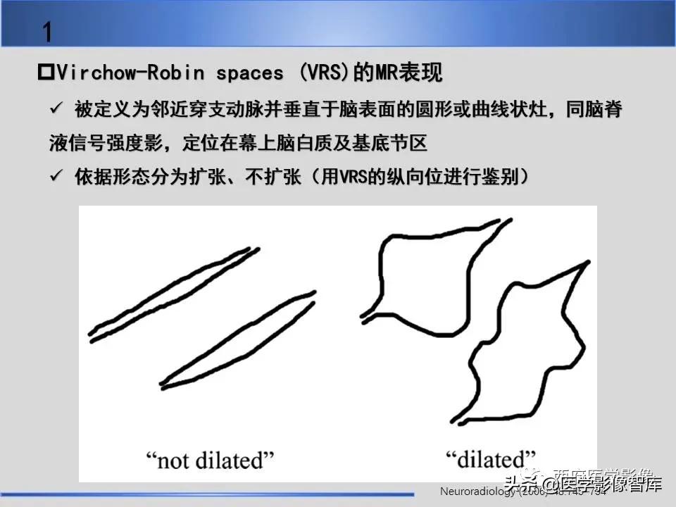 vr间隙概念,vr间隙需要做什么检查