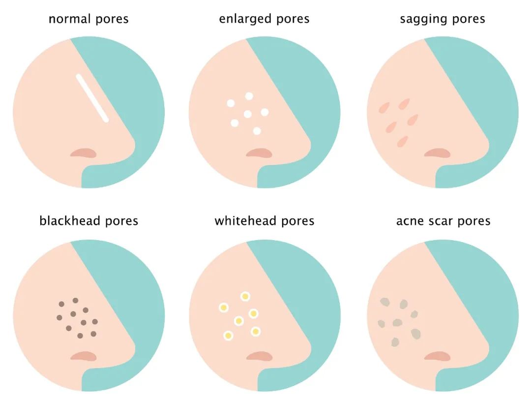 收缩毛孔比较靠谱的方法,收缩毛孔美颜妙招