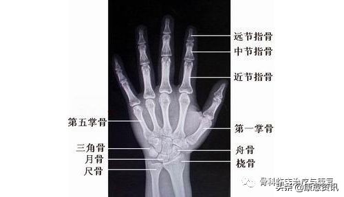 腕关节骨折康复训练,腕关节术后康复