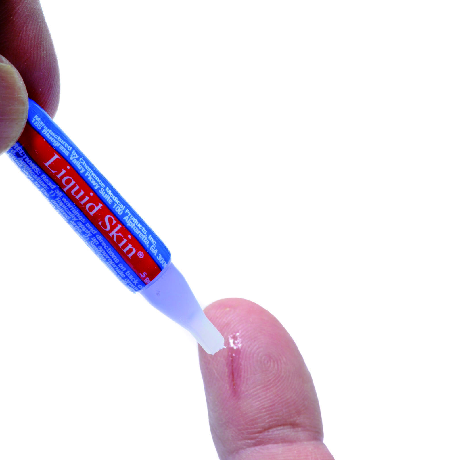 医用胶水缝合伤口多久能好,术后用胶水粘合的伤口多久会消失