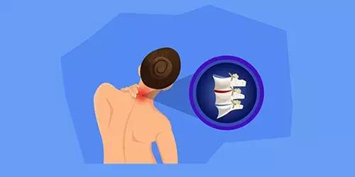 脖子咔咔响是骨头发出的吗,脖子咔咔响是颈椎骨质增生吗