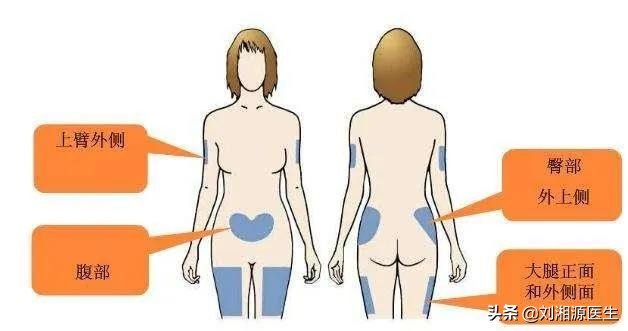 免疫治疗不良妊娠的方法,免疫相关不良妊娠检查