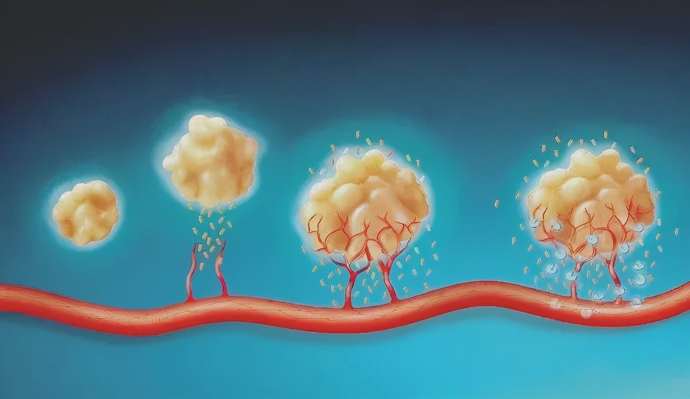 70岁老人化疗后手和脚肿正常吗,老人化疗之后身体越来越差