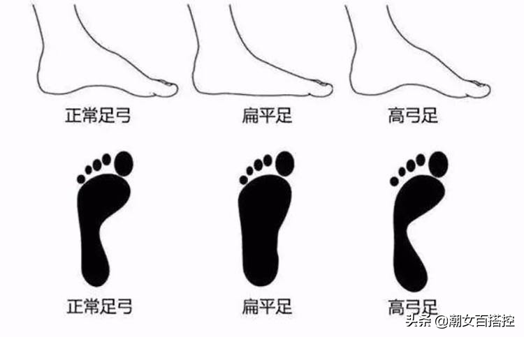 短靴怎么挑,秋冬短靴怎么搭时尚显瘦又百搭