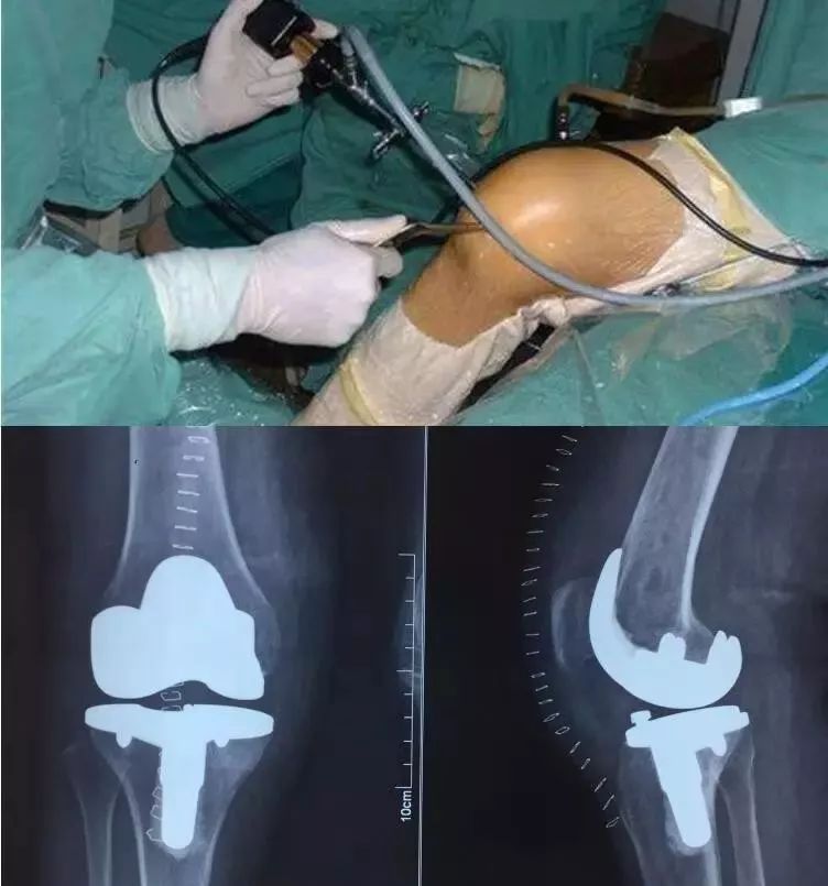 滑膜炎十大常见骨科疾病,骨科专家治滑膜炎偏方