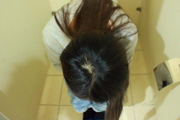 体内缺钾什么症状,体内缺钾能引起哪些症状