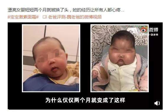 激素依赖性皮炎擦哪种药膏好,脸部过敏性皮炎十大药膏不含激素