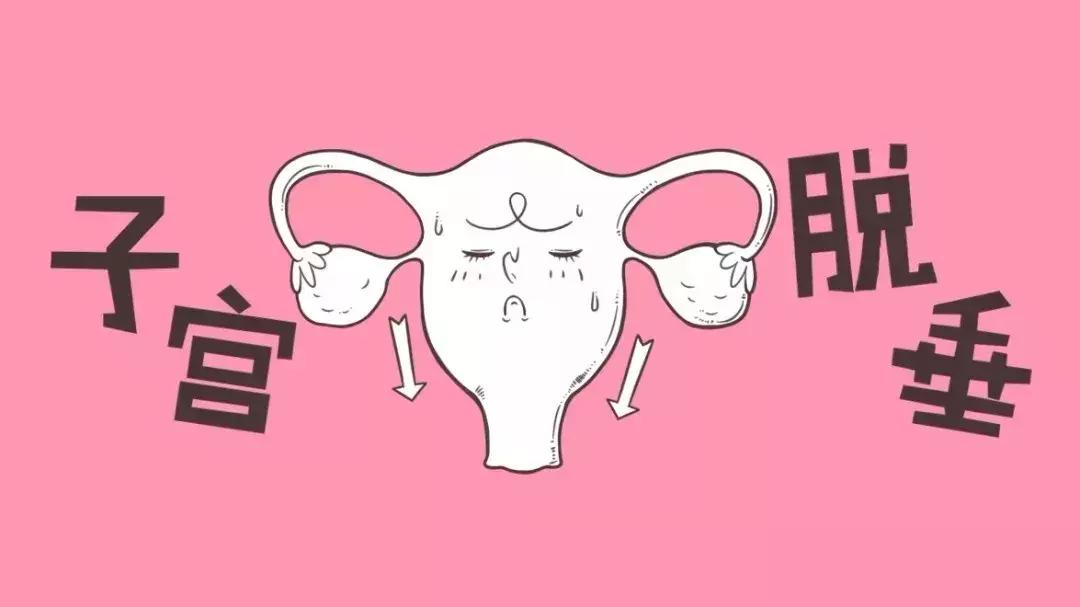 子宫脱垂什么仪器最好,子宫脱垂治疗仪器