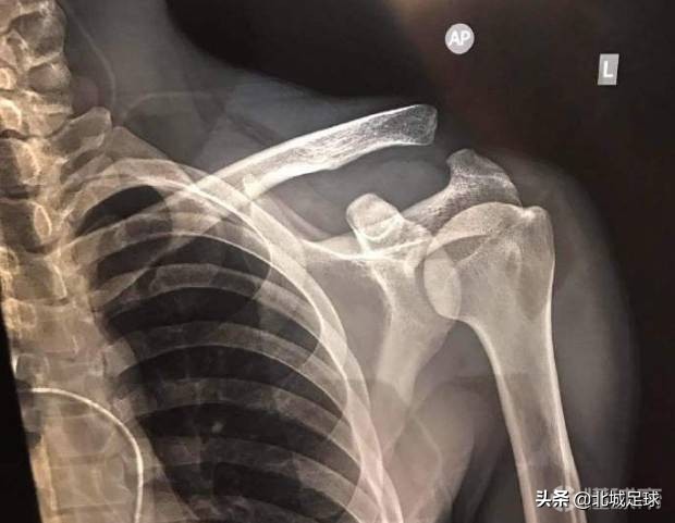 国足1-2乌兹别克斯坦武磊单刀,国足2比1泰国武磊错失单刀