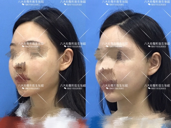 八大处张超抖音,八大处张超合集