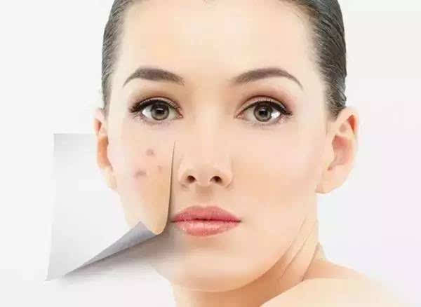 诗妍芙的痘印怎么去除,诗妍芙祛痘