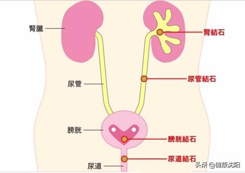 健康科普泌尿外科护理,泌尿外科健康科普知识