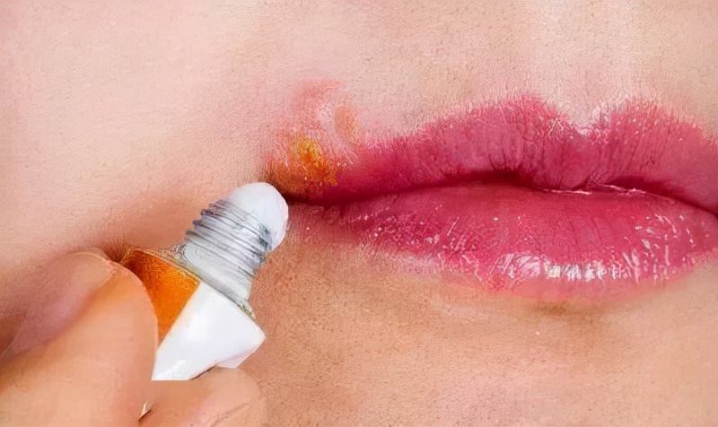 红霉素软膏,涂在脸上,会有什么变化?这些年不知道,“亏大”了