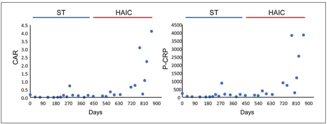 全身化疗能根治癌症吗,全身化疗的副作用有哪些