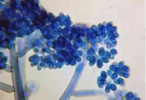 葡萄膨果期发生灰霉病,葡萄灰霉病对照图