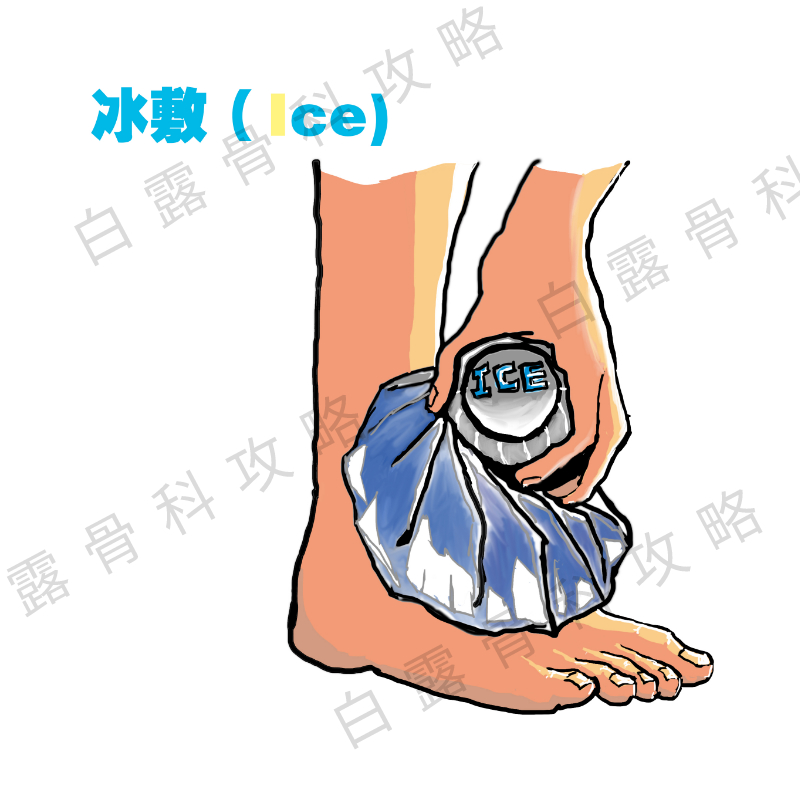 崴脚后48小时紧急处理,崴到脚紧急处理