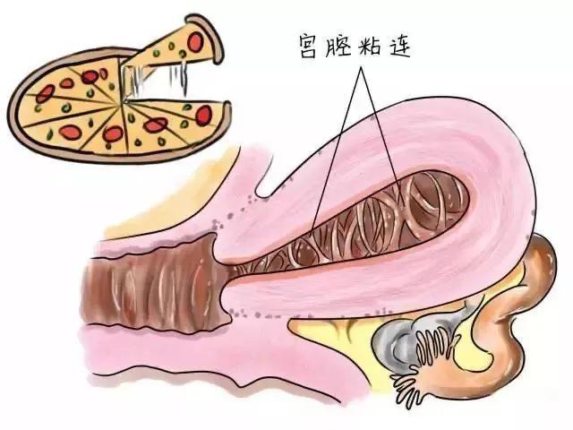 姨妈晚走一般因为什么,每个月大姨妈都来9天怎么回事