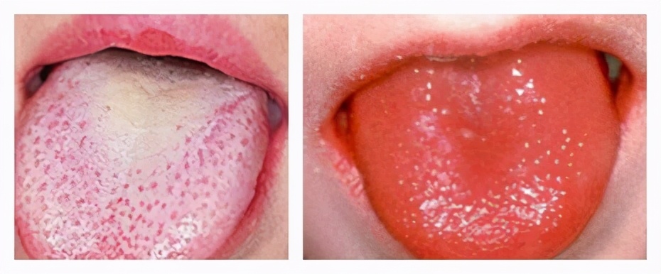 冬令进补四大误区,冬令进补哪些补药最适合