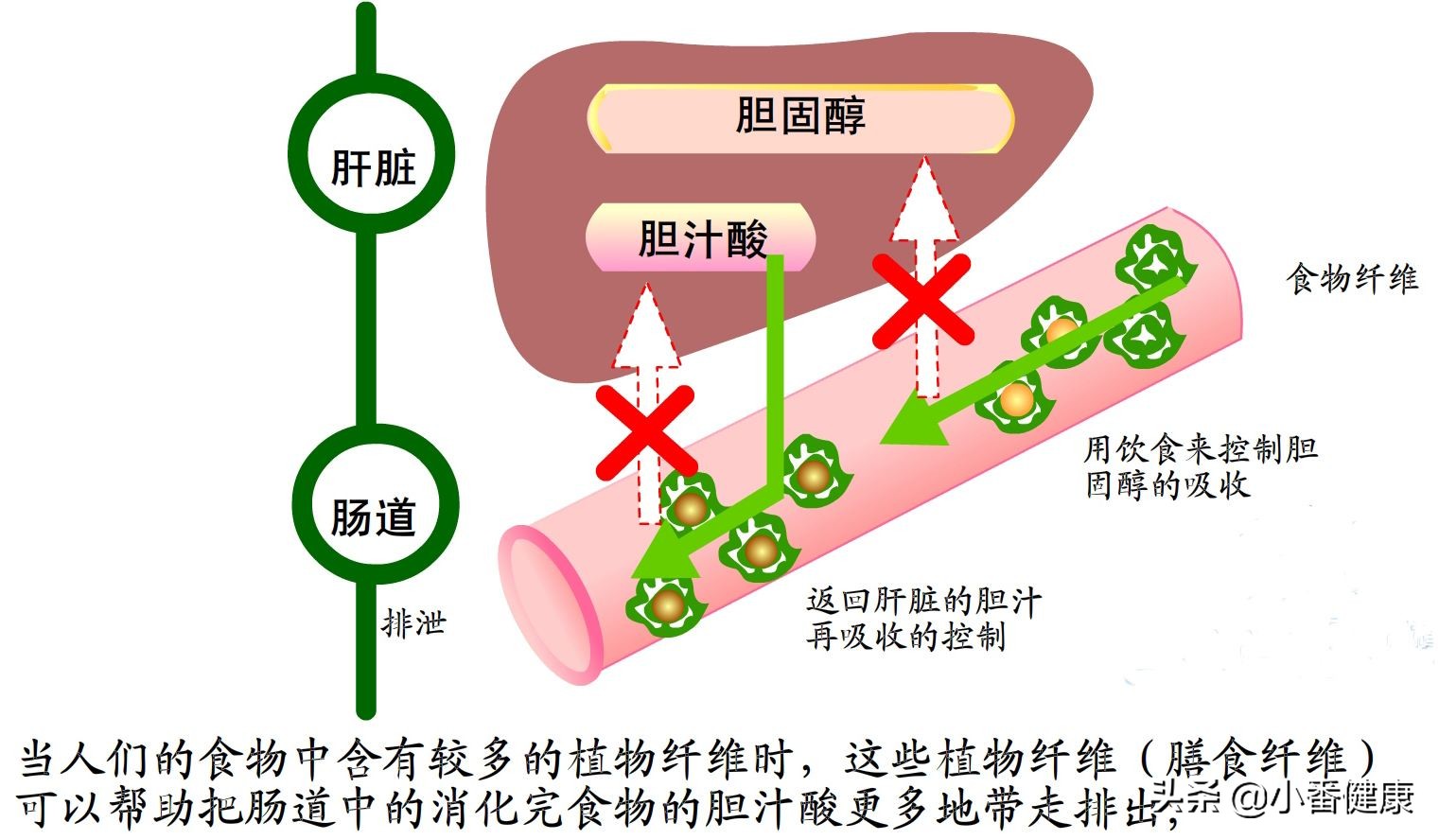 乙肝小三阳出现黄疸怎么治疗,乙肝大三阳黄疸高怎么办