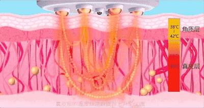 明星都是用什么牌子的美容仪,半个娱乐圈都用美容仪吗