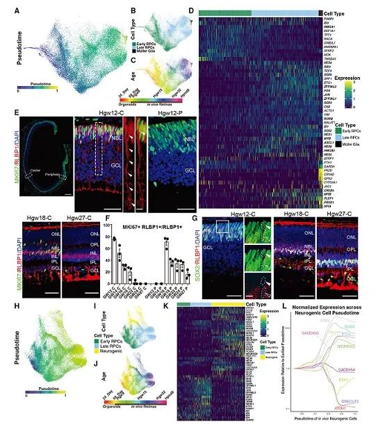 薛天​等利用单细胞测序技术成功揭示人类视网膜发育重要分子机制