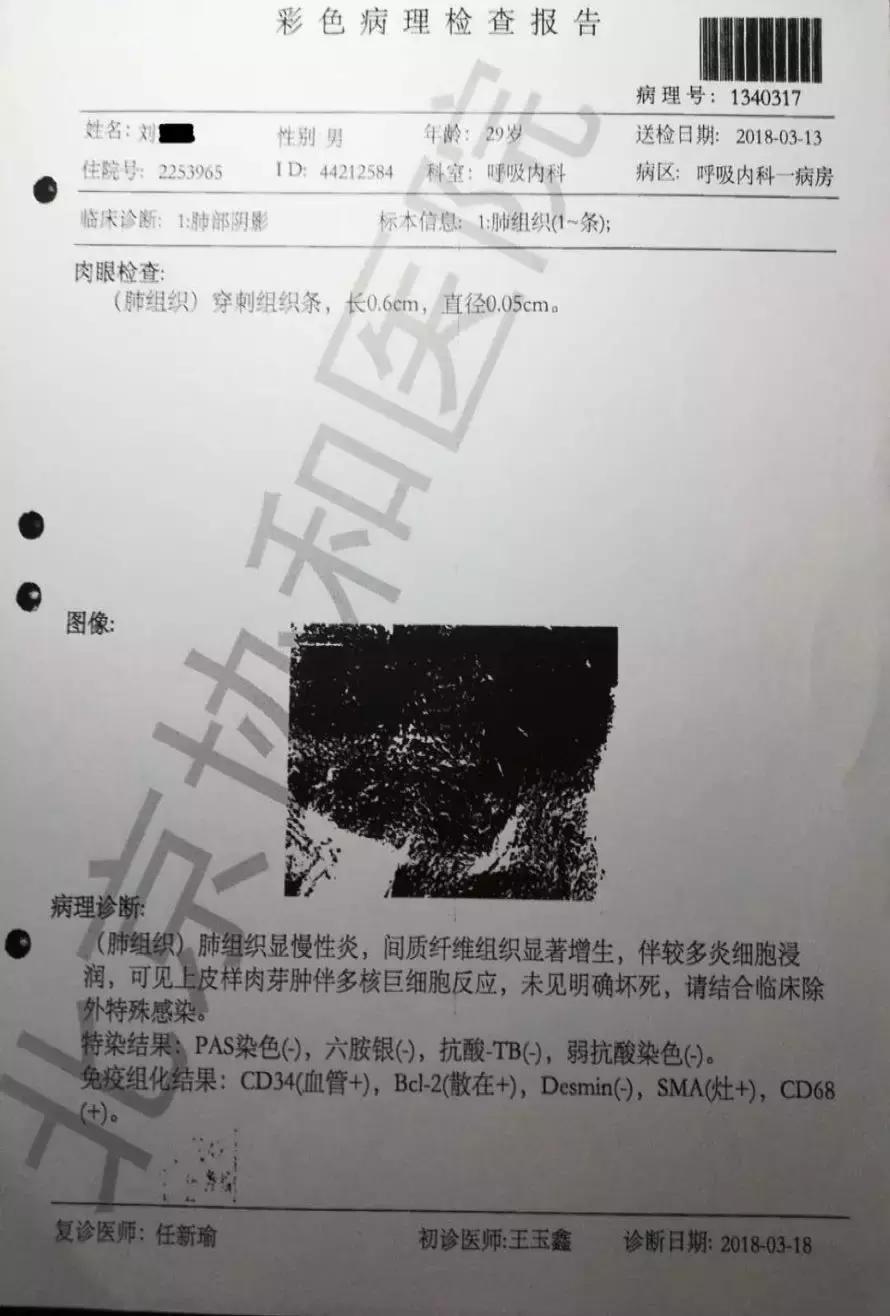 青年男性肺炎过后一直咳嗽怎么办,潜伏结核感染咳嗽咳痰