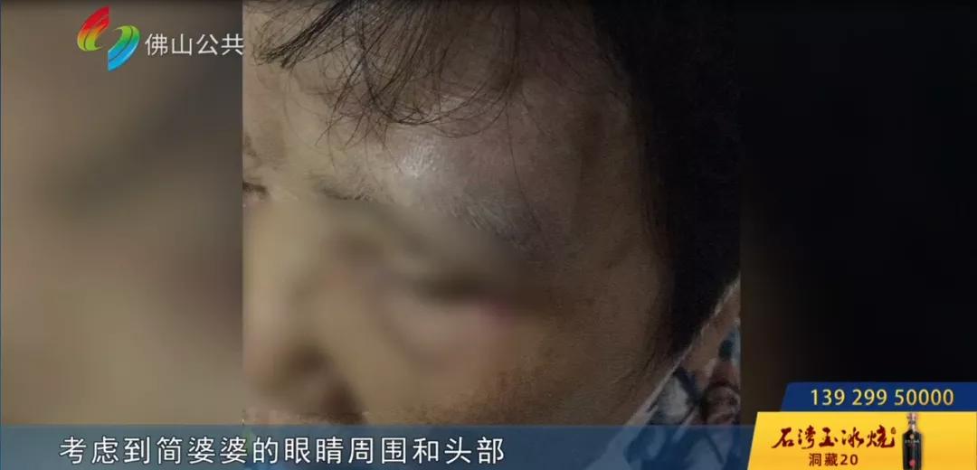 佛山八旬老人在B超室摔出“大包”!女儿大怒:“三个医生在场竟无人扶!”