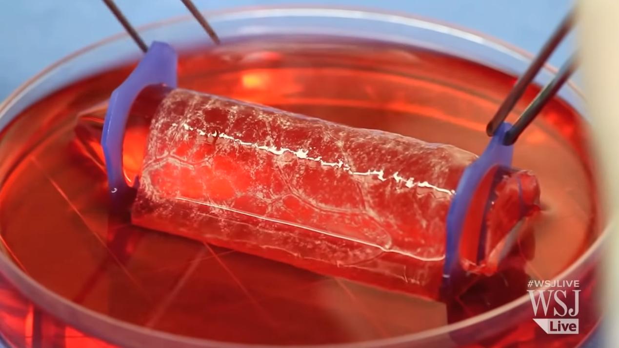 美国人造子宫实验成功,荷兰科学家发现人体新器官