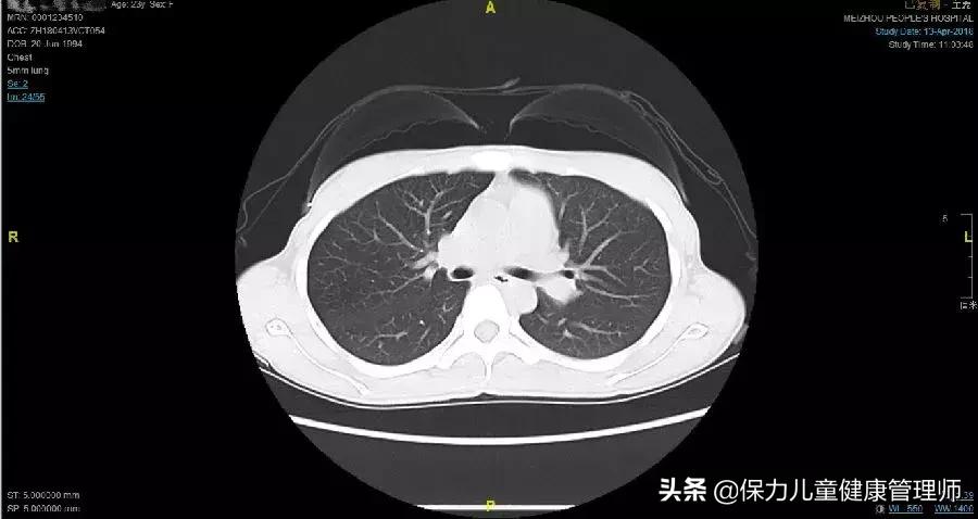 死亡率高达50%,死亡率高达50%到80%