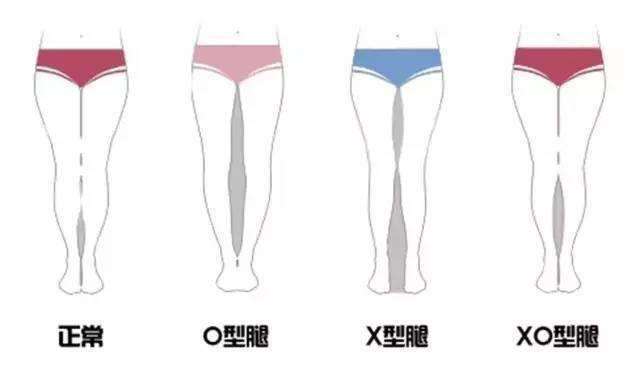 a字裙怎么搭配显瘦,a字裙长款适合什么身材穿