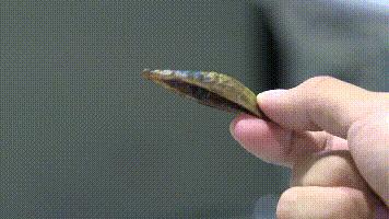 每天嚼5包槟榔连续吃10年,33岁小伙每天嚼两包槟榔嘴巴张开